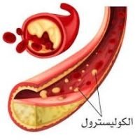 الكوليسترول